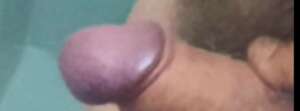 Accept